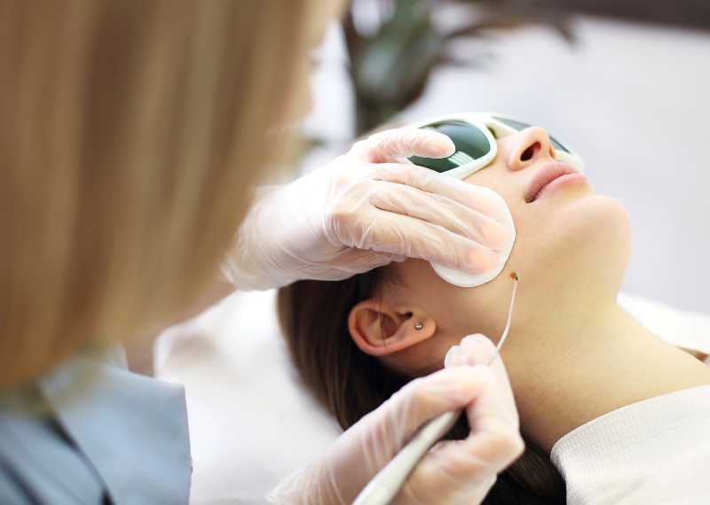 Cosmetic Mole Removal - Advanced Skin Cancer Centre