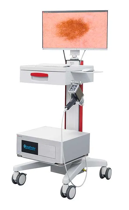 FotoFinder dermoscope opt.jpg