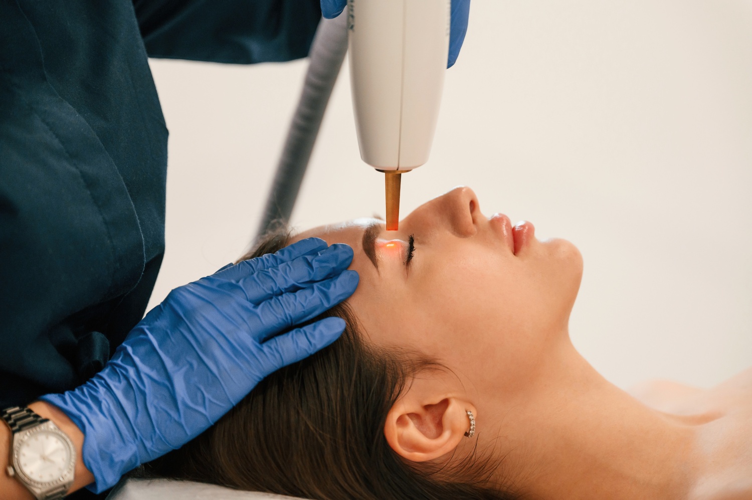 Laser Freckle Treatment